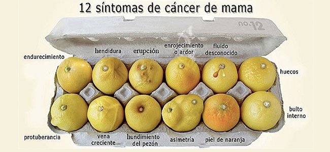 cáncer de mama