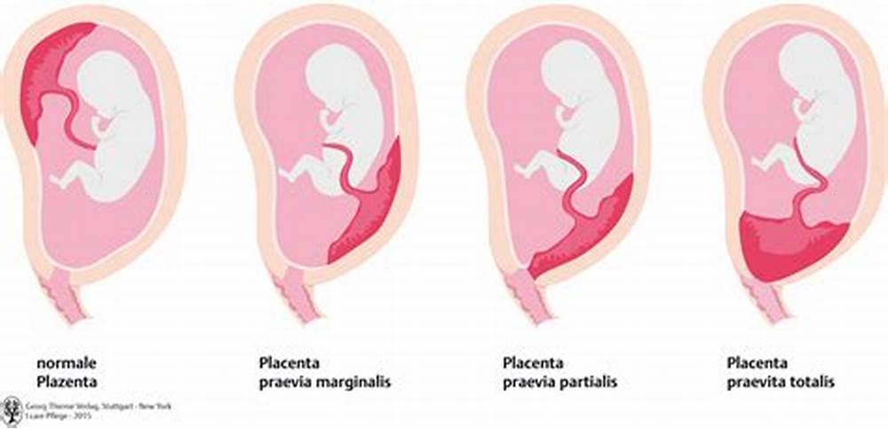 ¿Qué es la placenta?